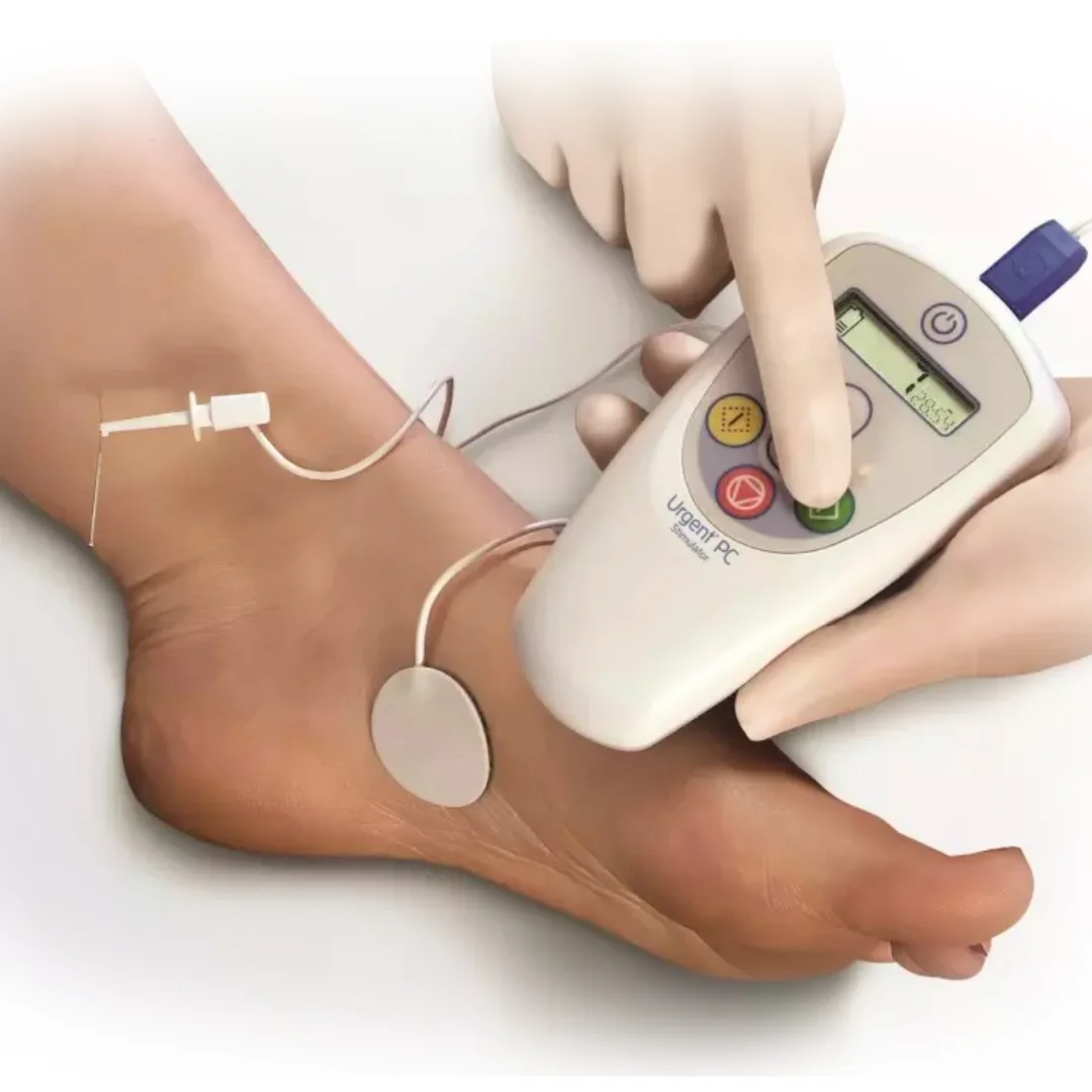 iCare Medical Group 的 PTNS 膀胱治療規劃