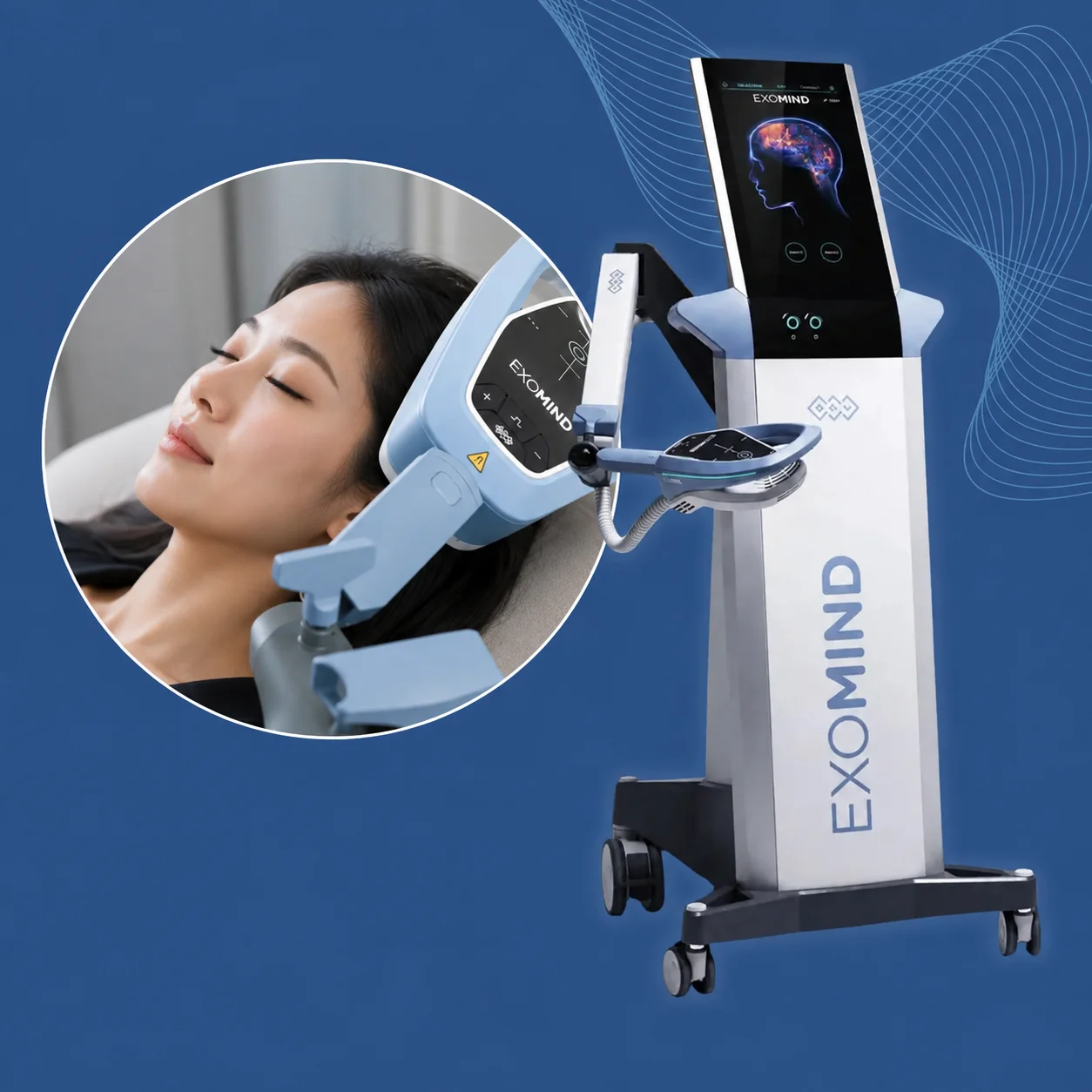 Exomind TMS consultation at iCare Medical Group